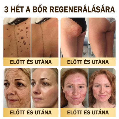 ⏳ Korlátozott ideig elérhető! Csak 3 doboz maradt! 🕔 Most akár 50% kedvezménnyel vásárolhatsz! 💥 Siess, és élvezd a megújulást még ma!