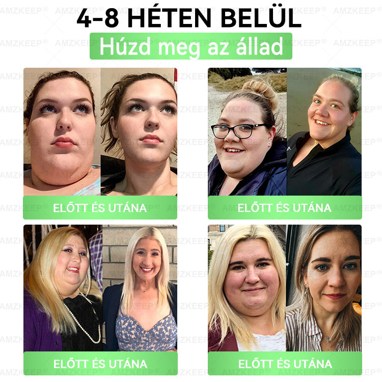 🇭🇺𝐇𝐢𝐯𝐚𝐭𝐚𝐥𝐨𝐬 Á𝐫𝐮𝐡á𝐳| 𝐀𝐌𝐙𝐊𝐄𝐄𝐏® 𝐁𝐞𝐫𝐛𝐞𝐫𝐢𝐧𝐞 × 𝐌𝐨𝐫𝐢𝐧𝐠𝐚 𝐒𝐥𝐢𝐦 & 𝐇𝐞𝐚𝐥𝐭𝐡𝐲 𝐍𝐚𝐧𝐨 𝐌𝐢𝐤𝐫𝐨𝐭ű𝐬 𝐓𝐚𝐩𝐚𝐬𝐳- 𝐍𝐚𝐩𝐨𝐧𝐭𝐚 𝐞𝐠𝐲𝐬𝐳𝐞𝐫, 𝐋á𝐭𝐡𝐚𝐭ó 𝐄𝐫𝐞𝐝𝐦é𝐧𝐲𝐞𝐤 𝟕 𝐍𝐚𝐩𝐨𝐧 𝐁𝐞ü𝐥 (𝐞𝐥𝐡í𝐳á𝐬, 𝐕𝐞𝐬𝐞𝐯𝐞𝐬𝐳𝐭é𝐬, 𝐂𝐮𝐤𝐨𝐫𝐛𝐞𝐭𝐞𝐠𝐬é𝐠, 𝐀𝐥𝐯á𝐬𝐳𝐚𝐯𝐚𝐫𝐨𝐤, 𝐈𝐳ü𝐥𝐞𝐭𝐢 𝐏𝐫𝐨𝐛𝐥é𝐦á𝐤 é𝐬 𝐄𝐠𝐲𝐞𝐛𝐞𝐤)