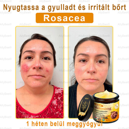 𝐀𝐥𝐥𝐲𝐁𝐞𝐞® 𝐛ő𝐫𝐤𝐞𝐳𝐞𝐥ő 𝐤𝐫é𝐦 ö𝐫𝐞𝐠𝐞𝐝é𝐬𝐠á𝐭𝐥ó, 𝐡𝐢𝐝𝐫𝐚𝐭á𝐥ó, 𝐛ő𝐫𝐣𝐚𝐯í𝐭ó, 𝐞𝐠𝐲𝐞𝐧𝐥𝐞𝐭𝐞𝐬 𝐭ó𝐧𝐮𝐬, 𝐩𝐚𝐭𝐭𝐚𝐧á𝐬𝐨𝐤 é𝐬 𝐬ö𝐭é𝐭 𝐟𝐨𝐥𝐭𝐨𝐤 𝐤𝐞𝐳𝐞𝐥é𝐬𝐞, 𝐬𝐳𝐞𝐦ö𝐥𝐜𝐬 é𝐬 𝐚𝐧𝐲𝐚𝐣𝐞𝐠𝐲 𝐞𝐥𝐭á𝐯𝐨𝐥í𝐭á𝐬𝐚, 𝐩𝐢𝐤𝐤𝐞𝐥𝐲𝐬ö𝐦ö𝐫 𝐞𝐧𝐲𝐡í𝐭é𝐬𝐞