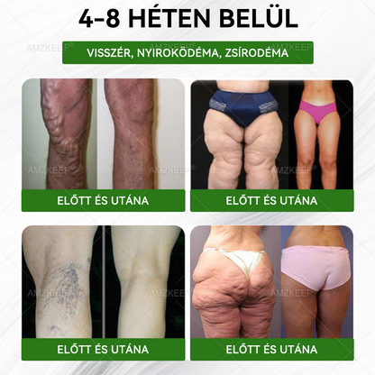 🎊🔥Utolsó esély! Ne hagyd ki ezt a lehetőséget, 50% kedvezménnyel! | AMZKEEP® Moringa · Berberin × NAD+ 10 az 1-ben fejlett nano mikrotűs tapasz