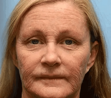 𝐀𝐥𝐥𝐲𝐁𝐞𝐞® 𝐛ő𝐫𝐤𝐞𝐳𝐞𝐥ő 𝐤𝐫é𝐦 ö𝐫𝐞𝐠𝐞𝐝é𝐬𝐠á𝐭𝐥ó, 𝐡𝐢𝐝𝐫𝐚𝐭á𝐥ó, 𝐛ő𝐫𝐣𝐚𝐯í𝐭ó, 𝐞𝐠𝐲𝐞𝐧𝐥𝐞𝐭𝐞𝐬 𝐭ó𝐧𝐮𝐬, 𝐩𝐚𝐭𝐭𝐚𝐧á𝐬𝐨𝐤 é𝐬 𝐬ö𝐭é𝐭 𝐟𝐨𝐥𝐭𝐨𝐤 𝐤𝐞𝐳𝐞𝐥é𝐬𝐞, 𝐬𝐳𝐞𝐦ö𝐥𝐜𝐬 é𝐬 𝐚𝐧𝐲𝐚𝐣𝐞𝐠𝐲 𝐞𝐥𝐭á𝐯𝐨𝐥í𝐭á𝐬𝐚, 𝐩𝐢𝐤𝐤𝐞𝐥𝐲𝐬ö𝐦ö𝐫 𝐞𝐧𝐲𝐡í𝐭é𝐬𝐞